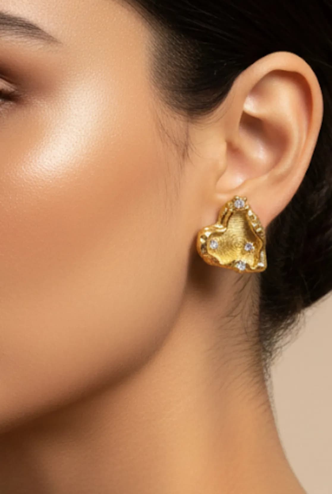ARETES
